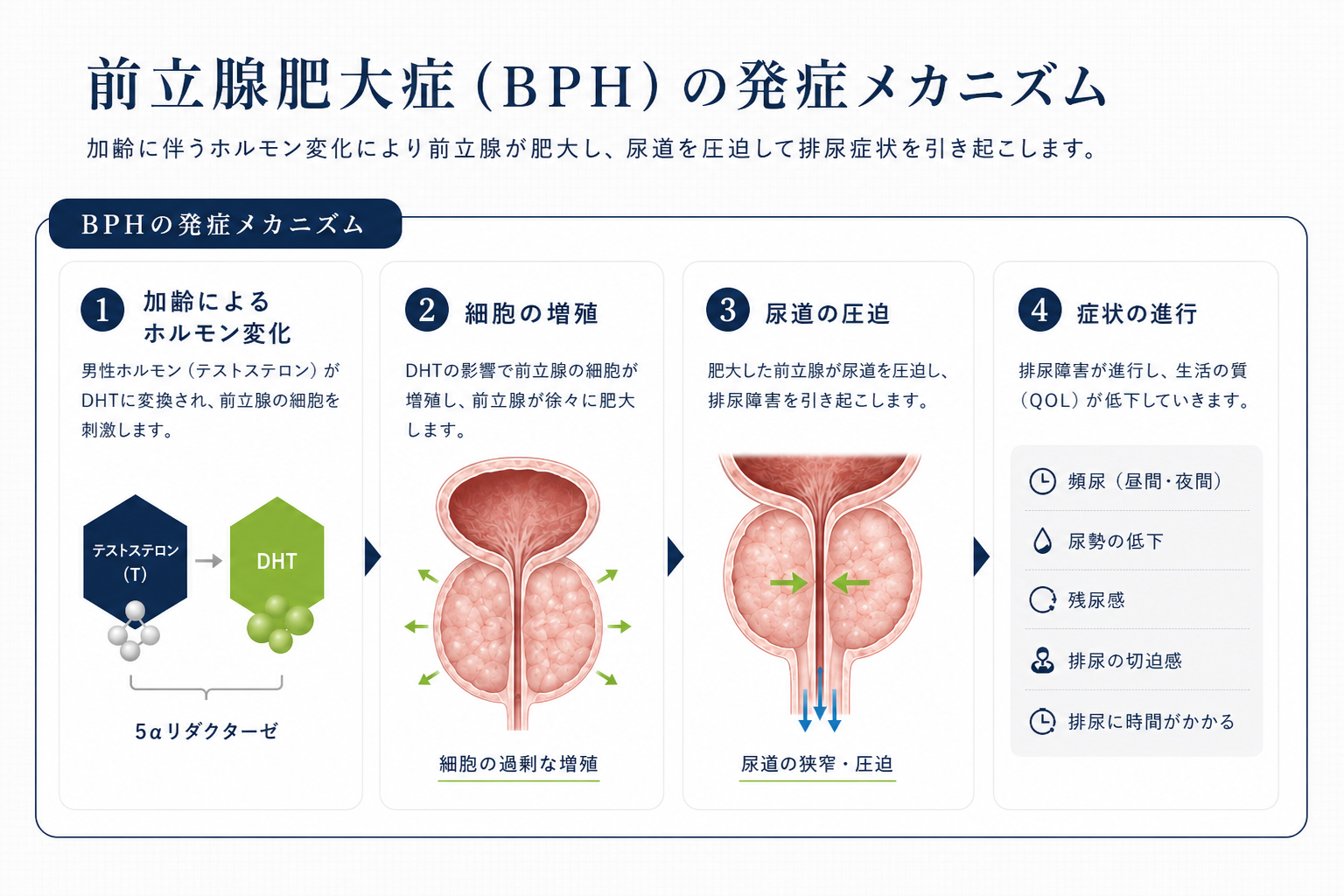 前立腺肥大症