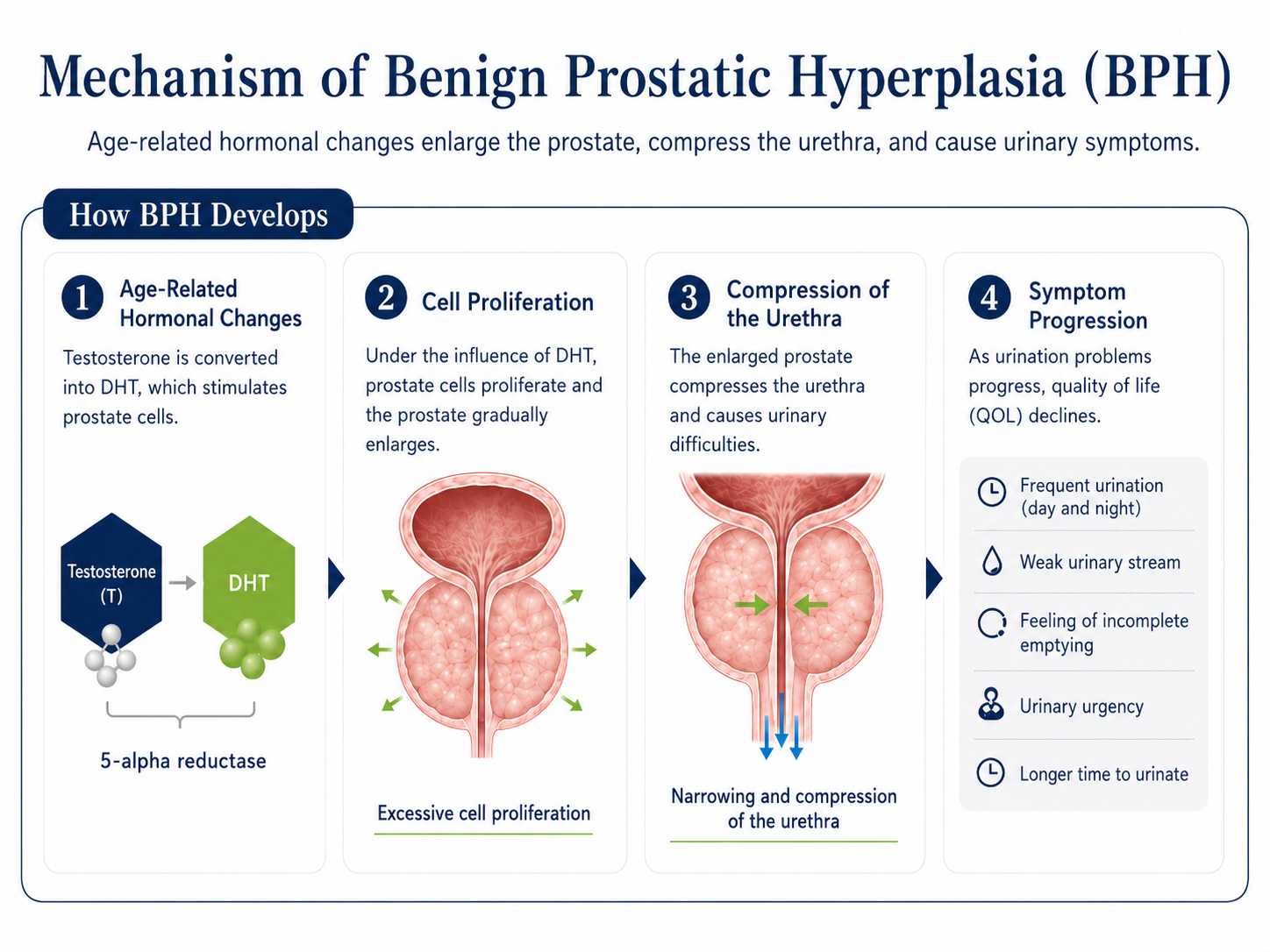 Benign Prostatic Hyperplasia